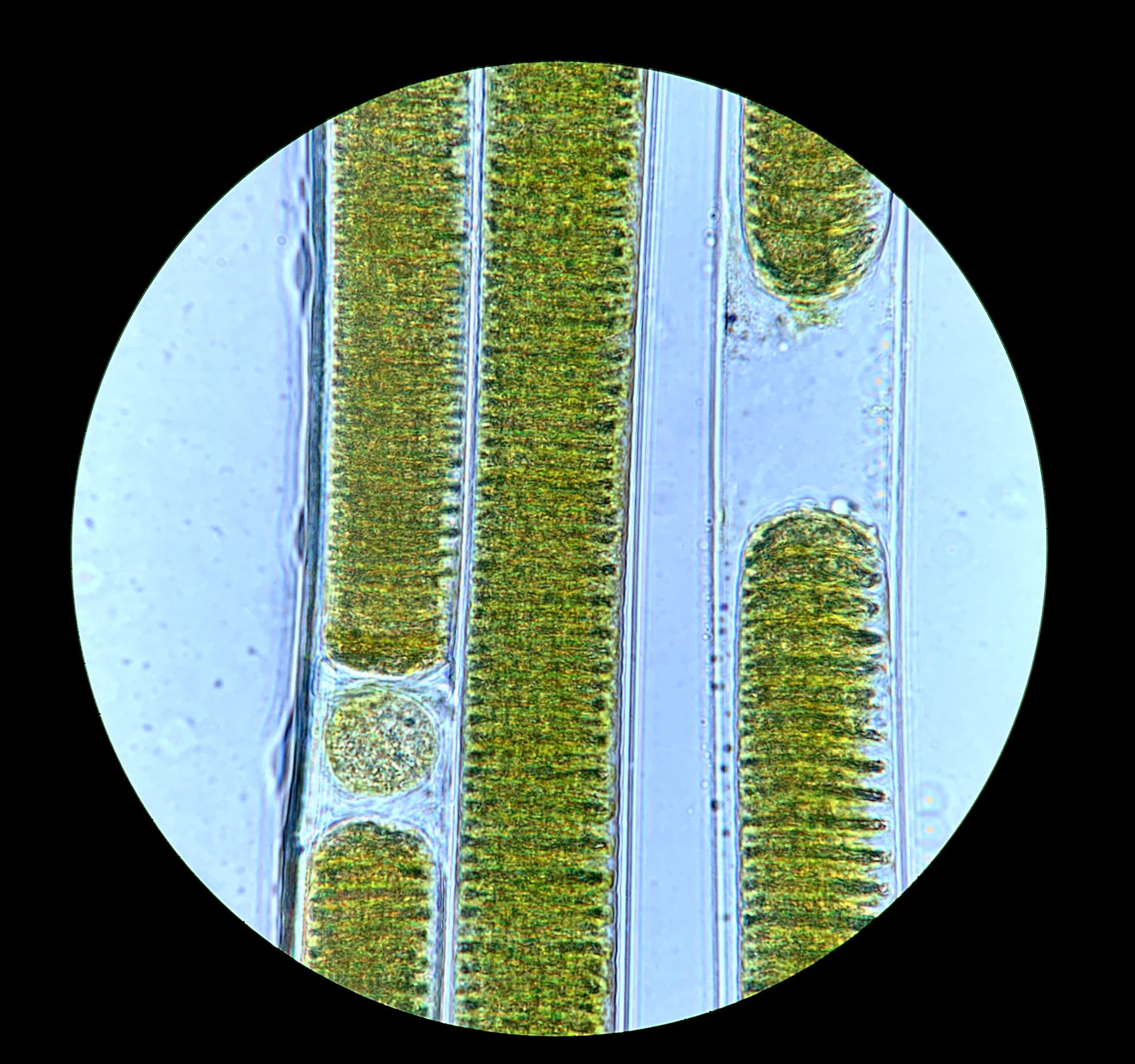 cyanobacteria bloom